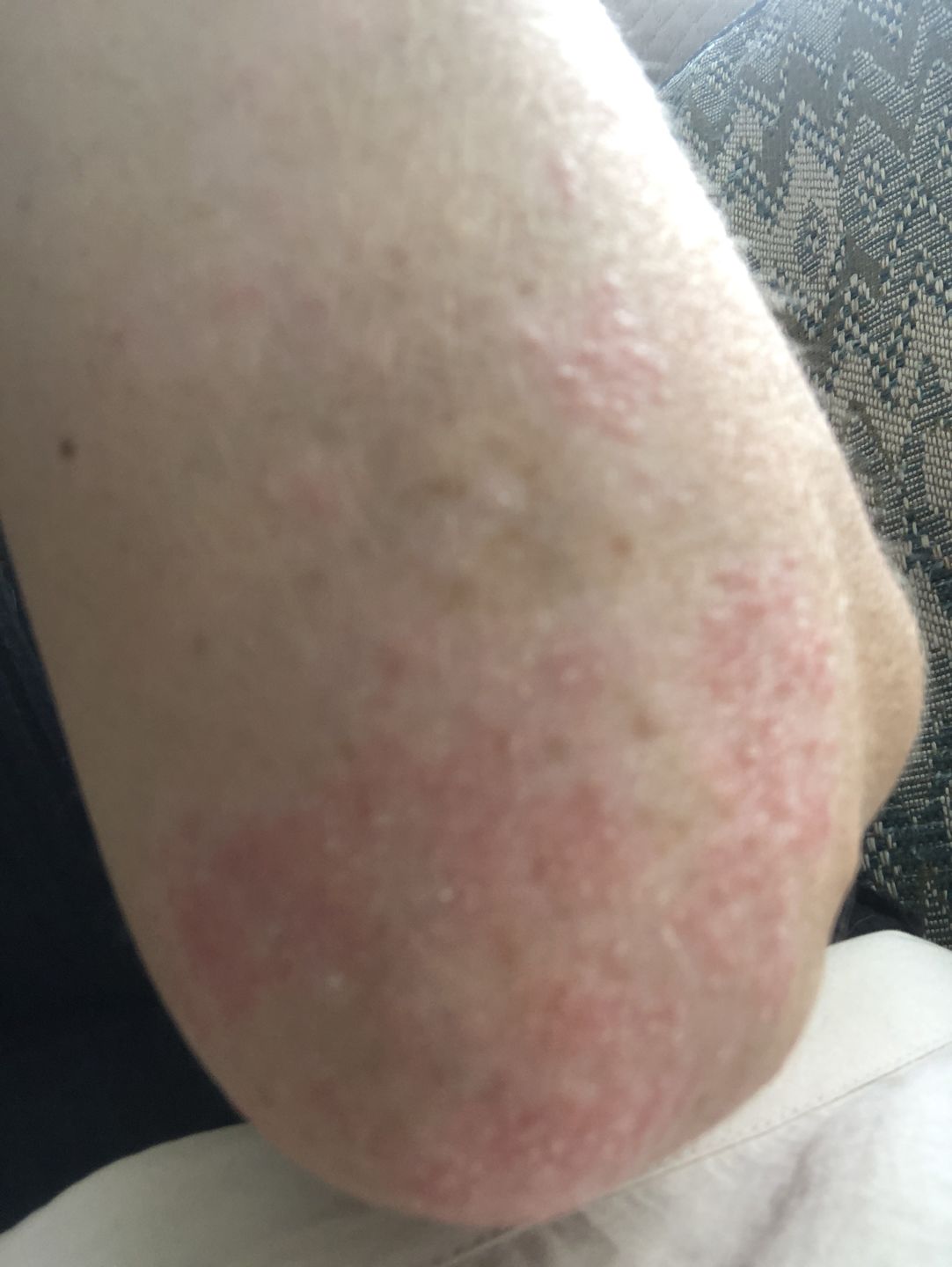 Customer photo review of Soothing Spray