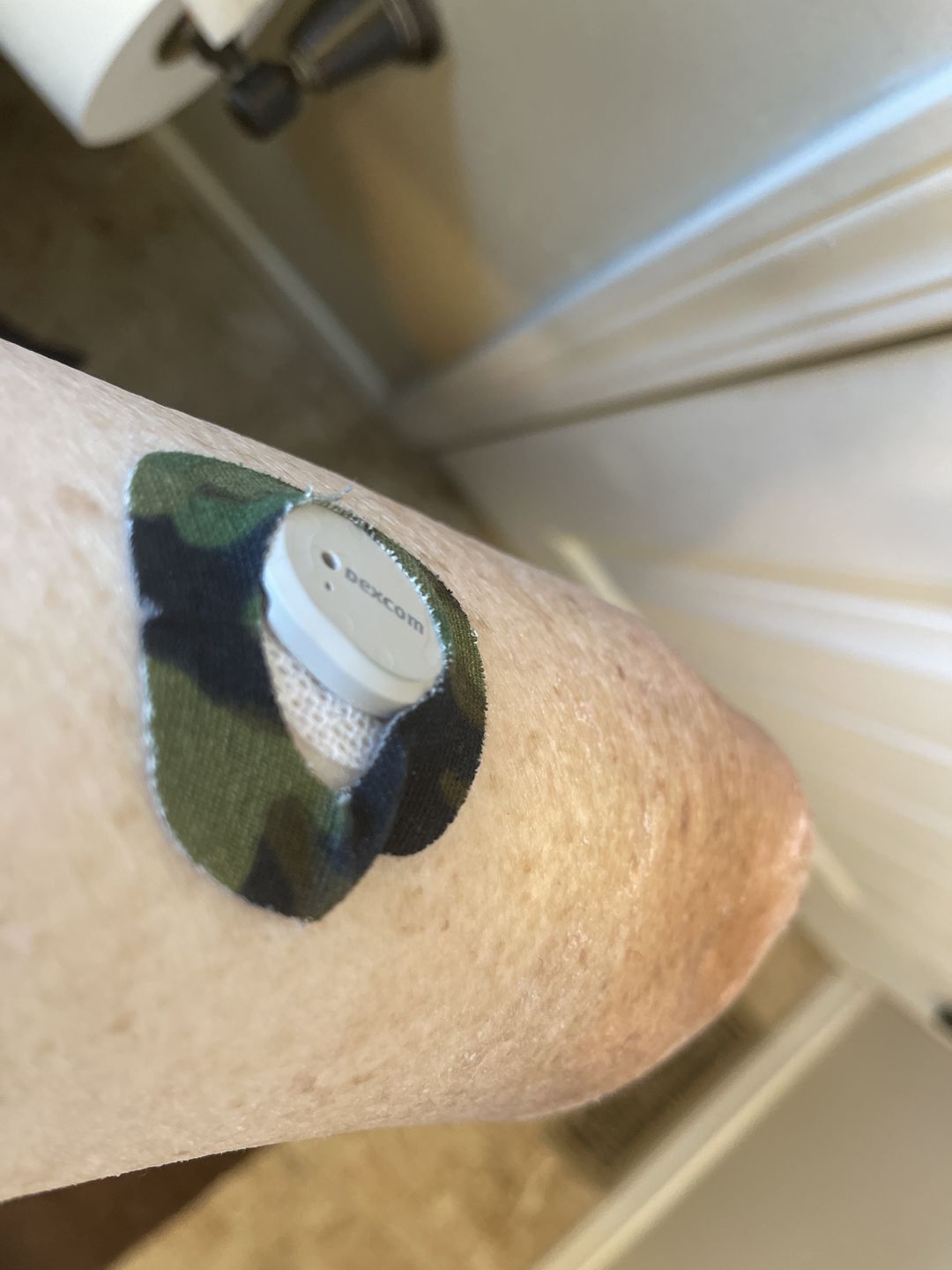 Customer photo review of Skin Grip Original - Dexcom G7 Adhesive Patches (With Hole)