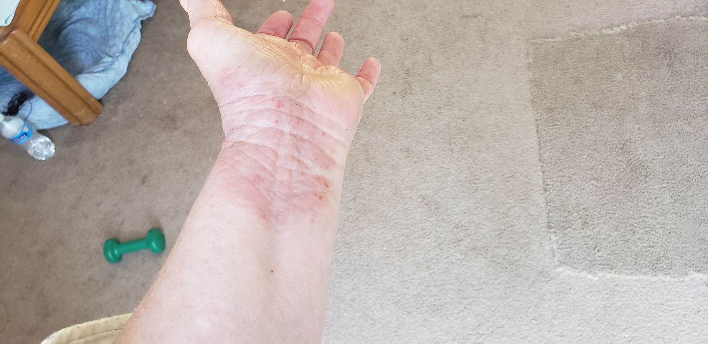 Customer photo review of Healing Salve | CBD