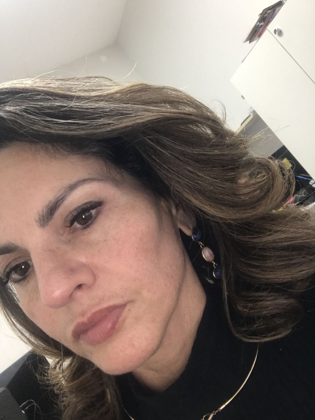 Customer photo review of RADIANT SKIN - ROSE DROPS