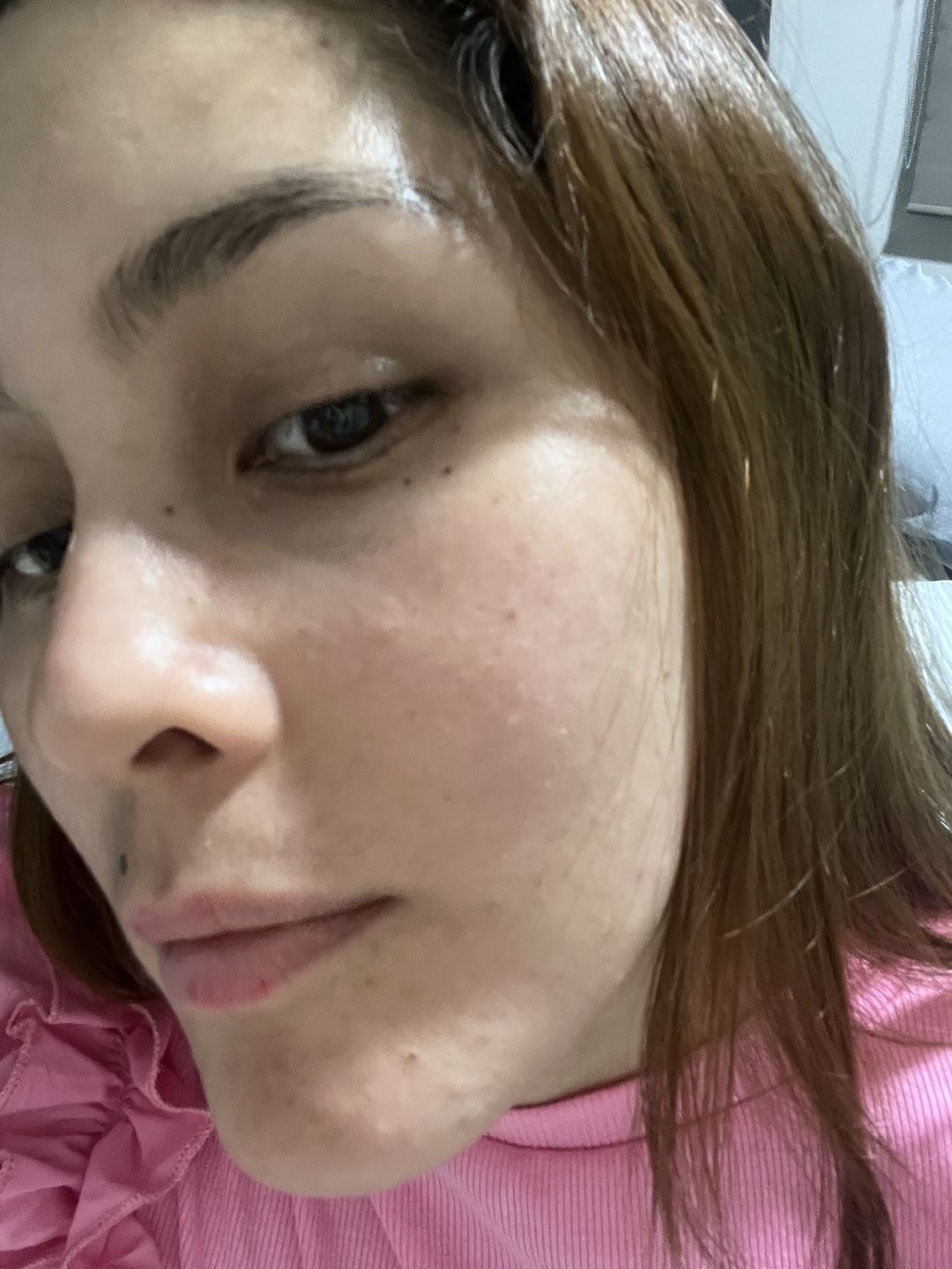 Customer photo review of Kit Los Esenciales (47% OFF) - Serum de Vitamina C 30ml + Serum de Niacinamida 30ml + Serum de Ácido Hialurónico 30ml