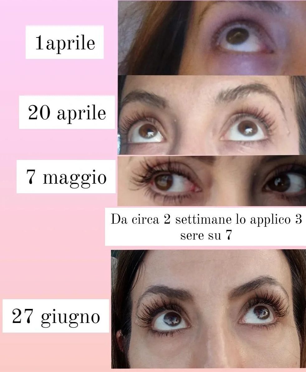 Customer photo review of Long Lashes FOREVER