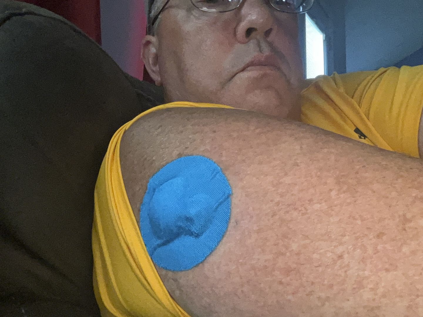 Customer photo review of Skin Grip Original - Freestyle Libre Adhesive Patches