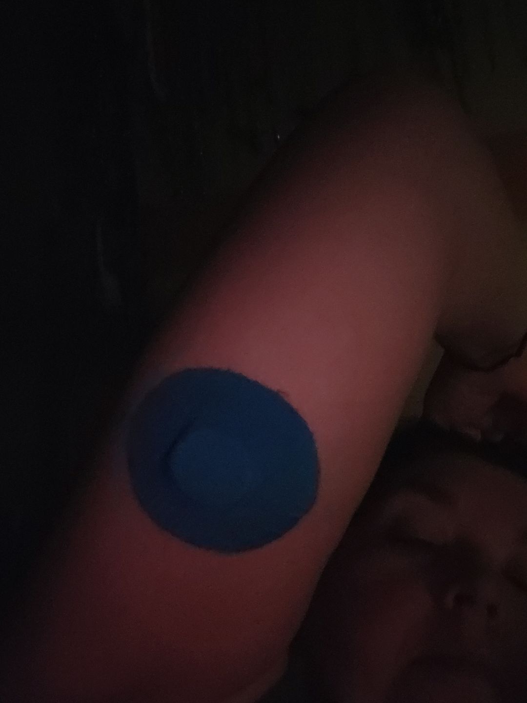 Customer photo review of Skin Grip Original - Freestyle Libre Adhesive Patches