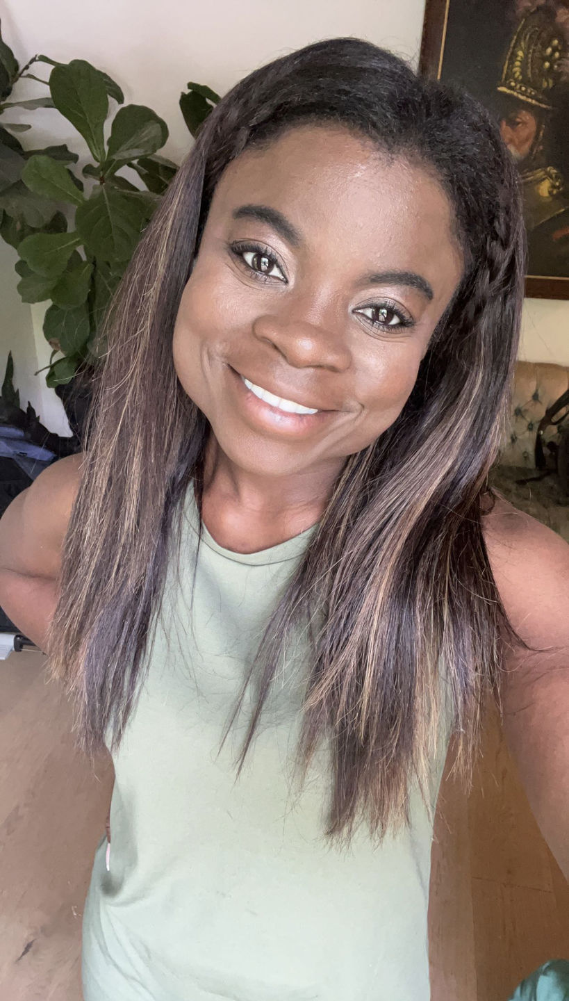 Customer photo review of ETERNAL TEETH WHITENING KIT
