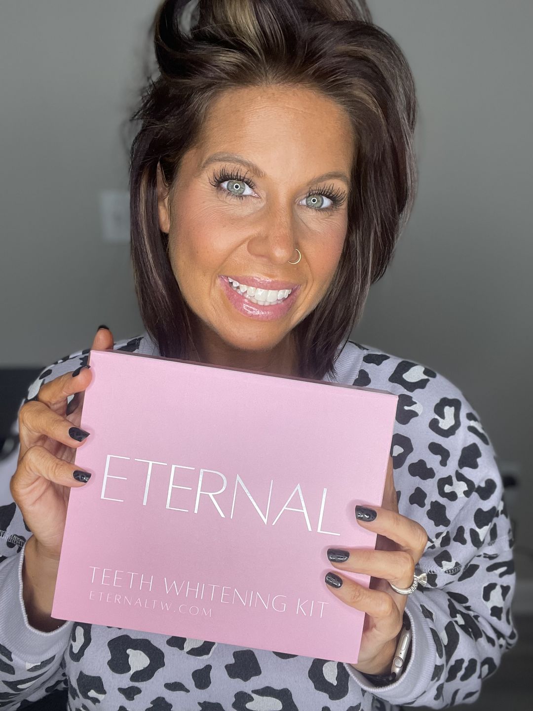 Customer photo review of ETERNAL TEETH WHITENING KIT