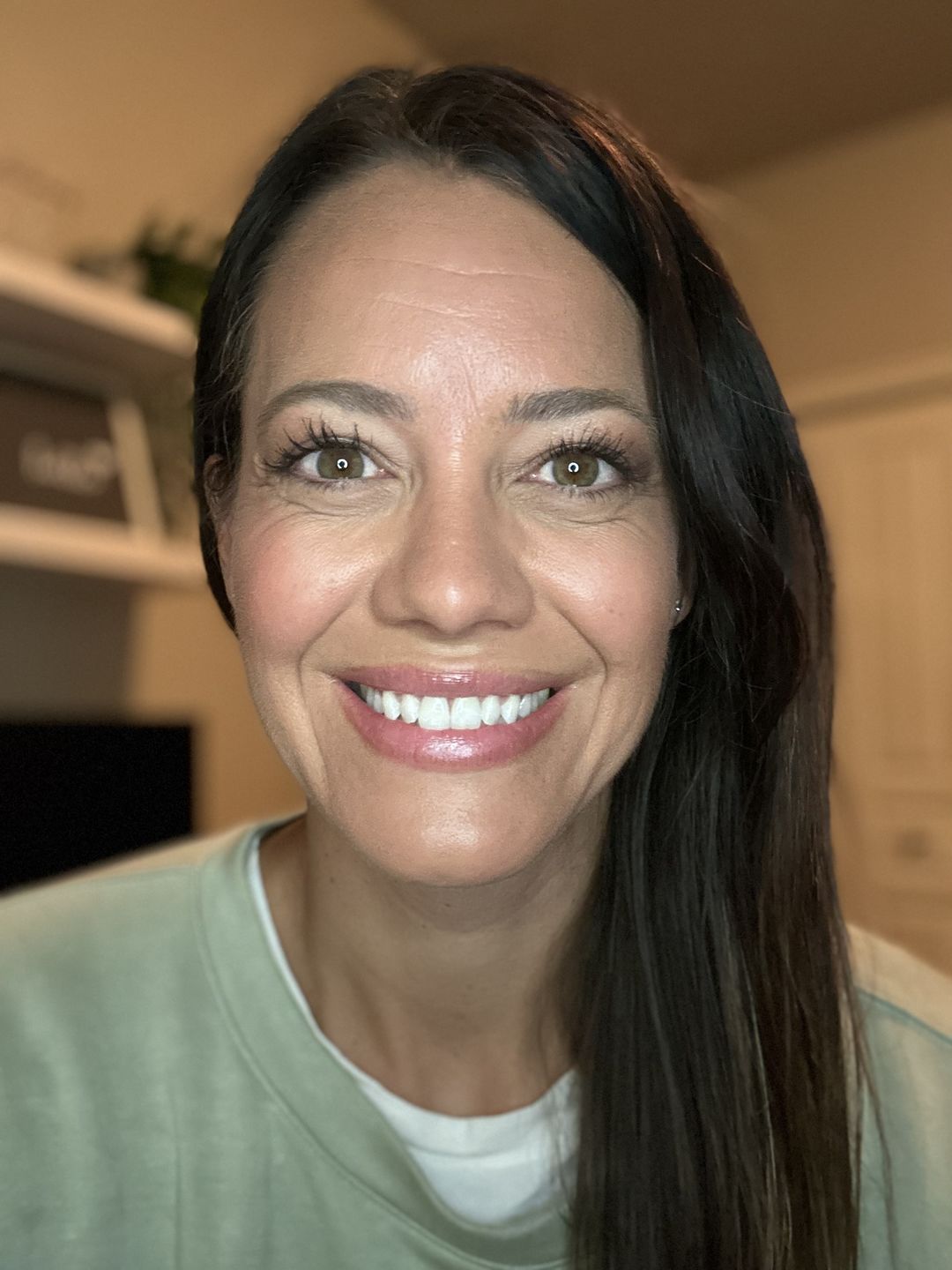 Customer photo review of ETERNAL TEETH WHITENING KIT