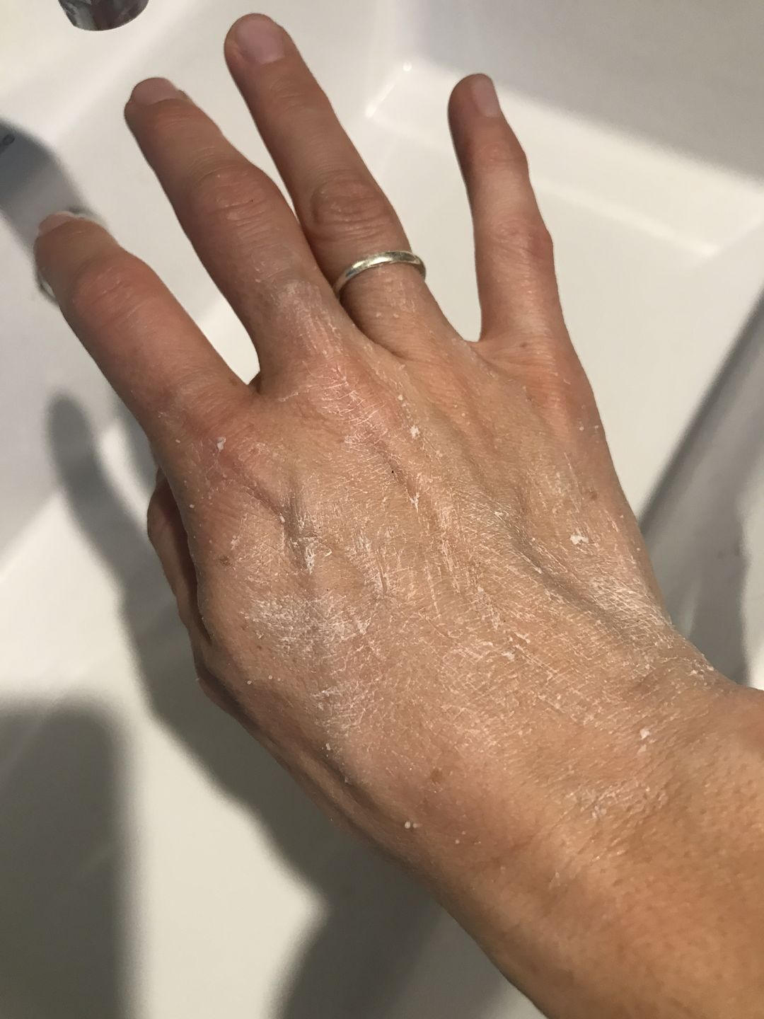 Customer photo review of Dragonfruit Face Scrub