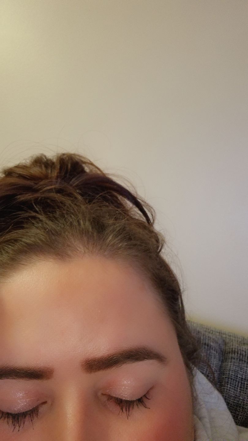 Customer photo review of Eyelash Growth Serum - Original