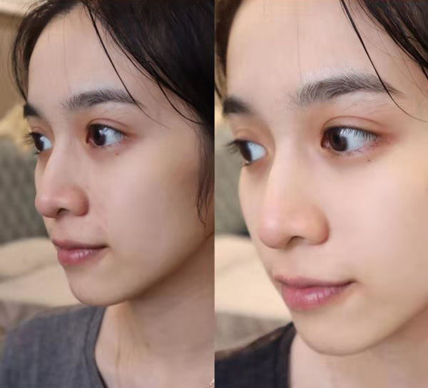 Customer photo review of [IN] GLOW Cure Éclat