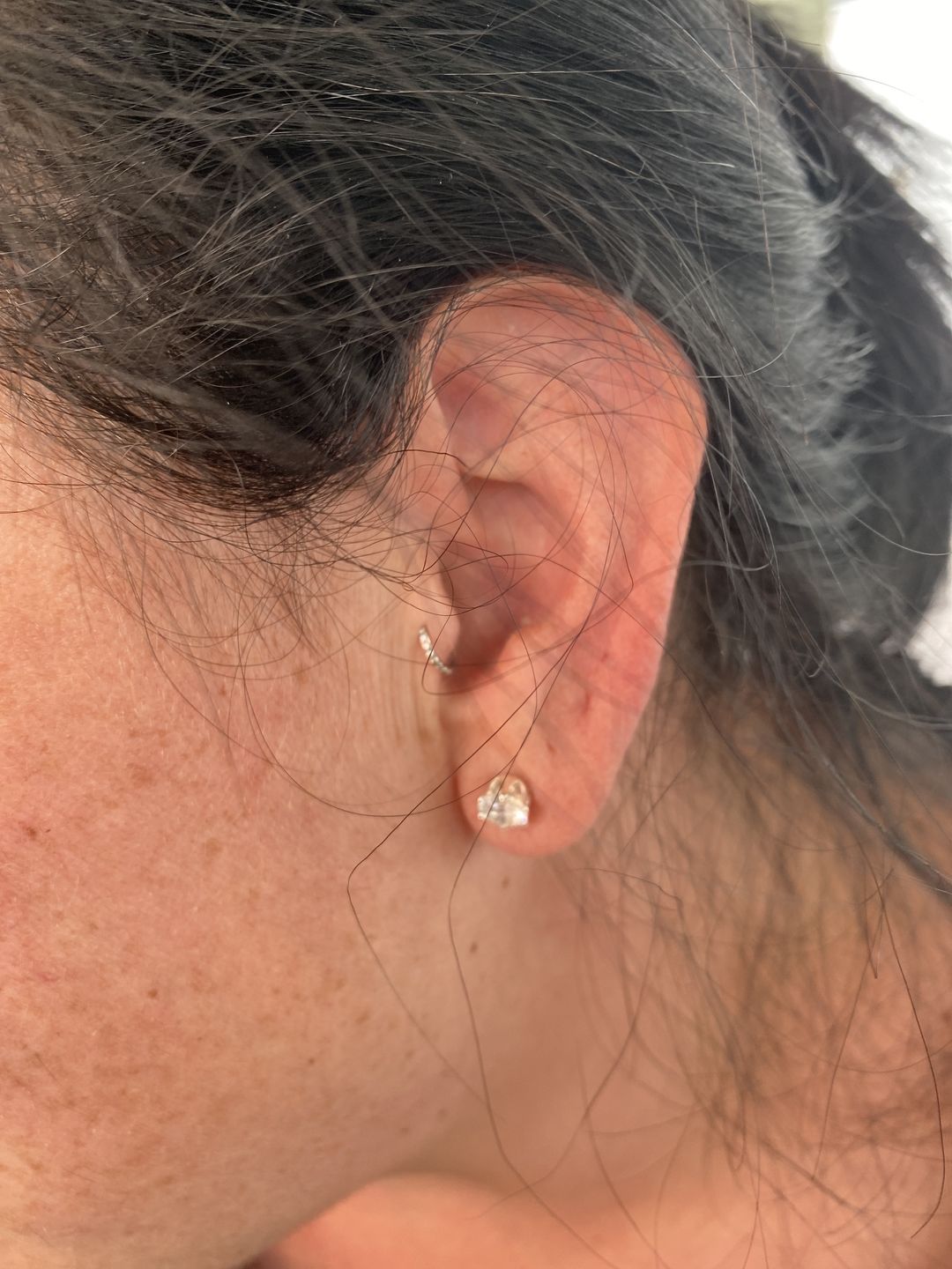 Customer photo review of Crystal Ball Piercing | Chirurgenstahl