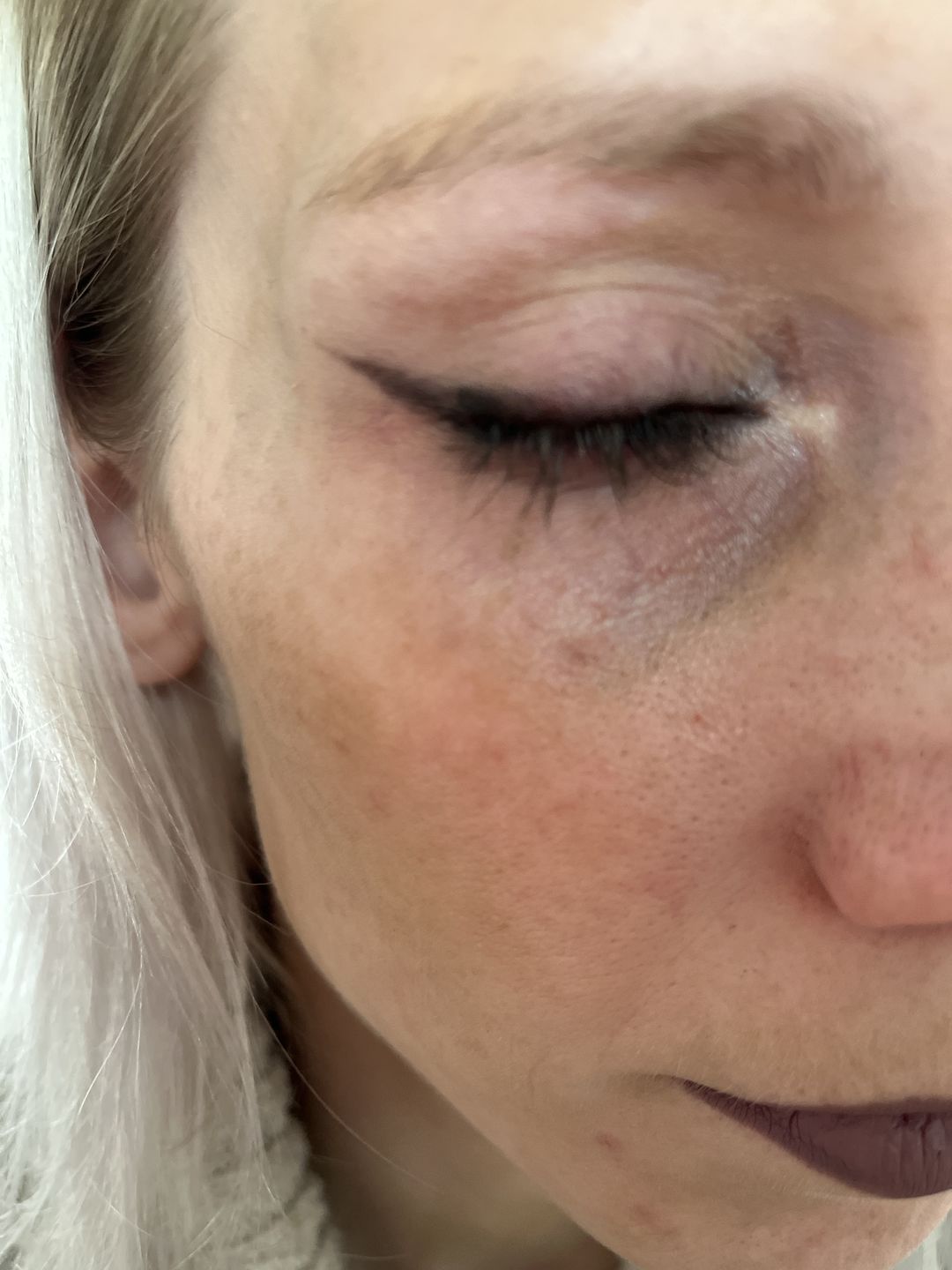 Customer photo review of fLASH Eyelash Serum