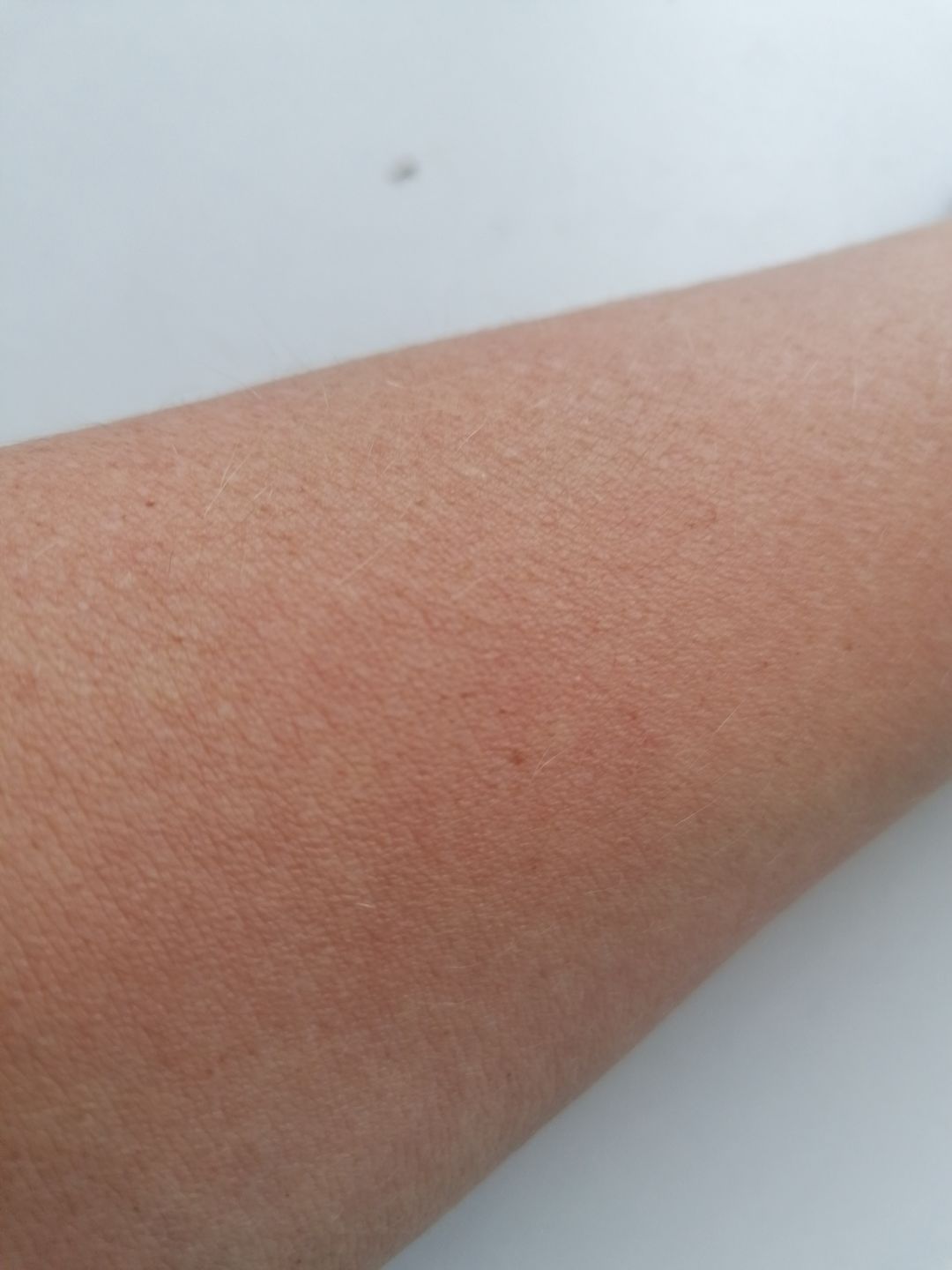 Customer photo review of Acide Hyaluronique - 1 mois