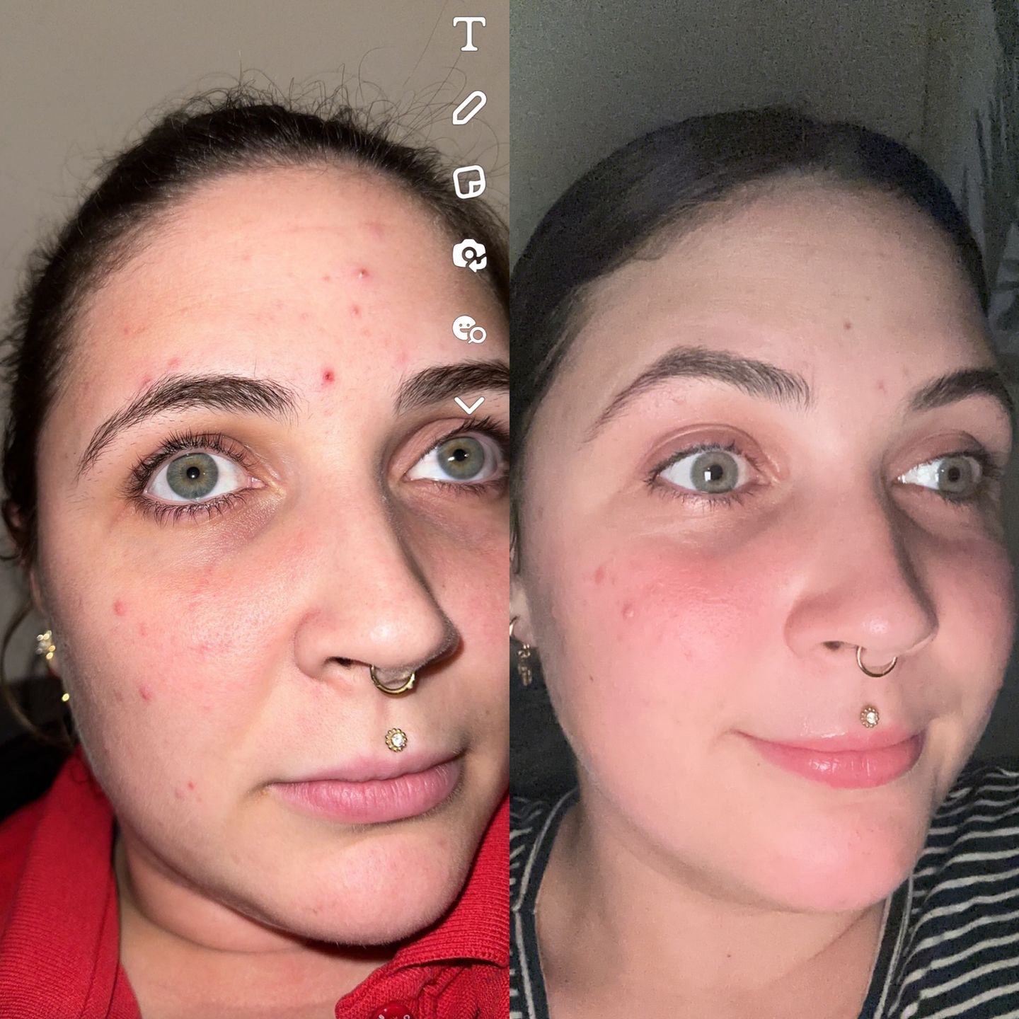 Customer photo review of 4 STEP STARTER KIT SAVE 10%