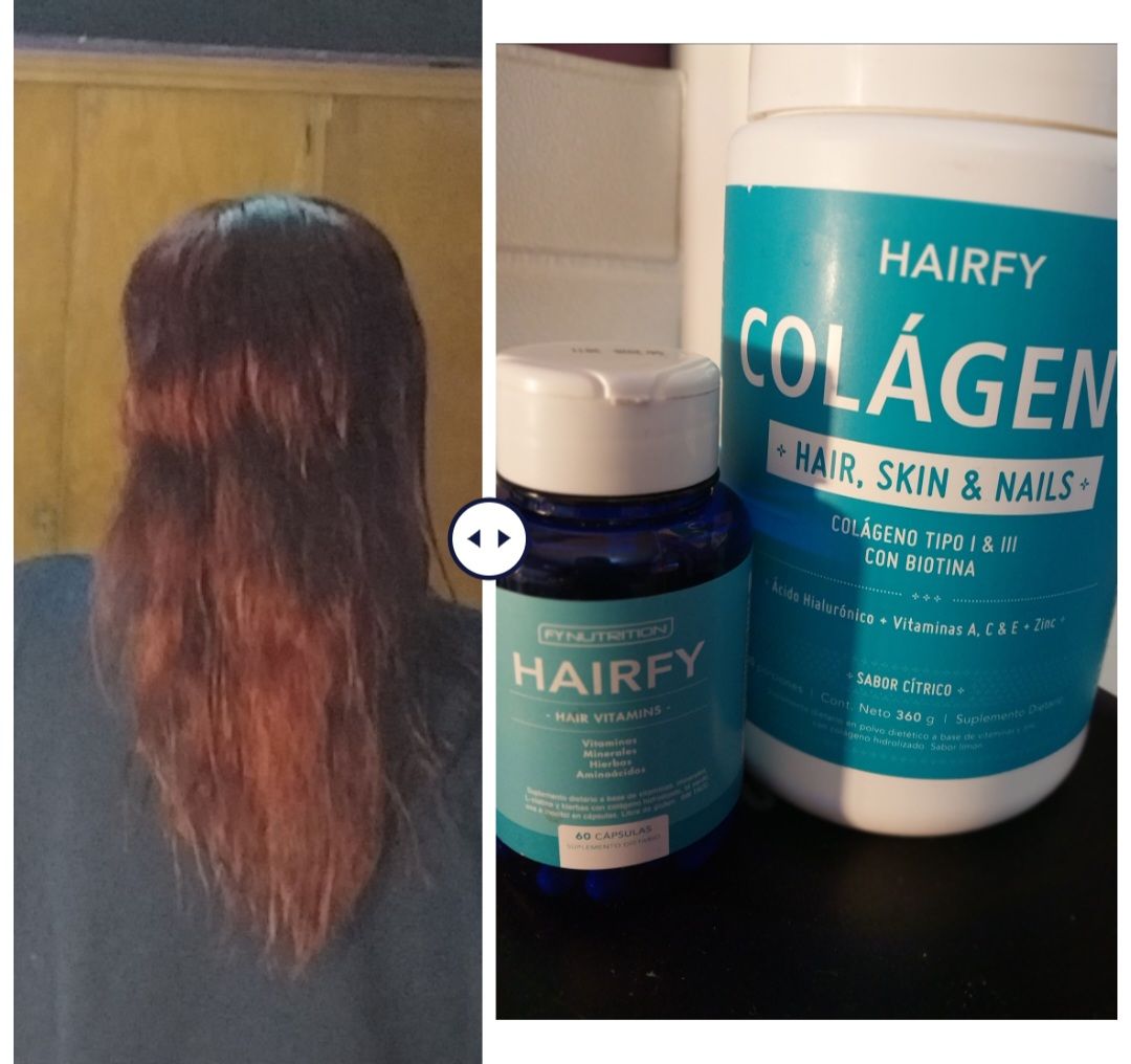 Customer photo review of Colágeno Hair, Skin & Nails