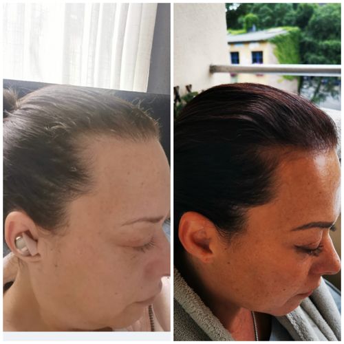 Customer photo review of TRÈS[S] GROWN - Hair Growth Serum