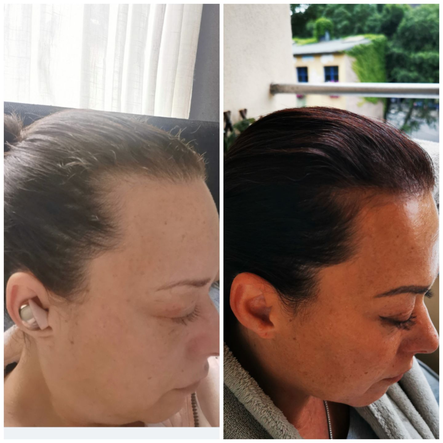 Customer photo review of TRÈS[S] GROWN - Hair Growth Serum