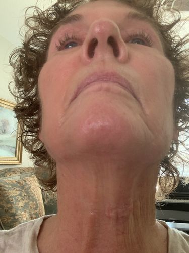 Customer photo review of Scar Gel