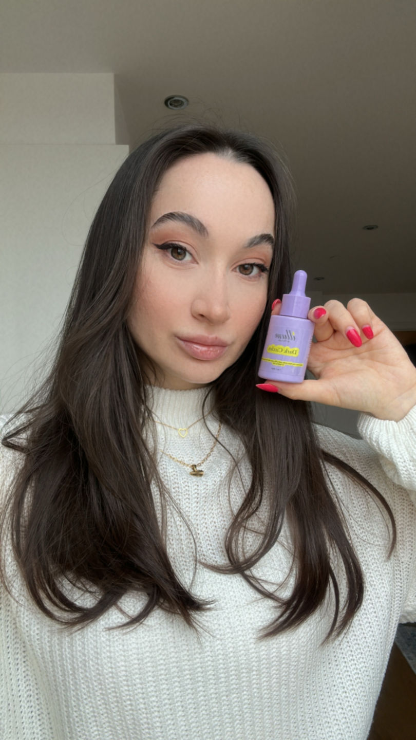 Customer photo review of Dark Circles Treatment