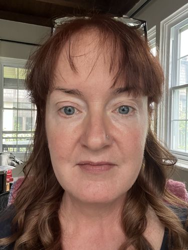 Customer photo review of EvenSkyn® Lumo: Premium Anti-Aging & Skin Tightening Handset