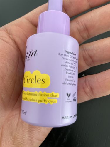 Customer photo review of Dark Circles Treatment