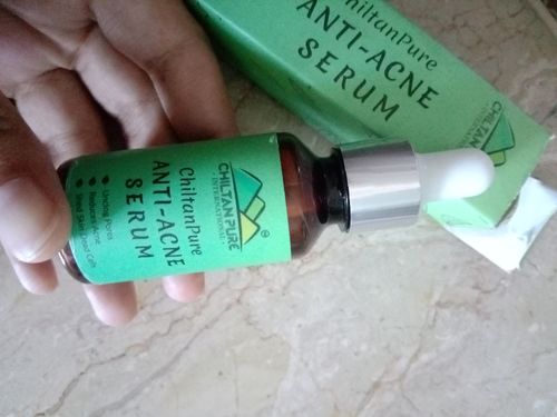 Customer photo review of Anti – Acne Serum – Brightens Skin, Fades Acne, Lighten Acne Scars & Control Excess Oil Production