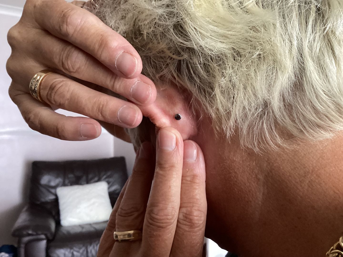 Customer photo review of Junipurr Titanium Flatback Labret Threadless