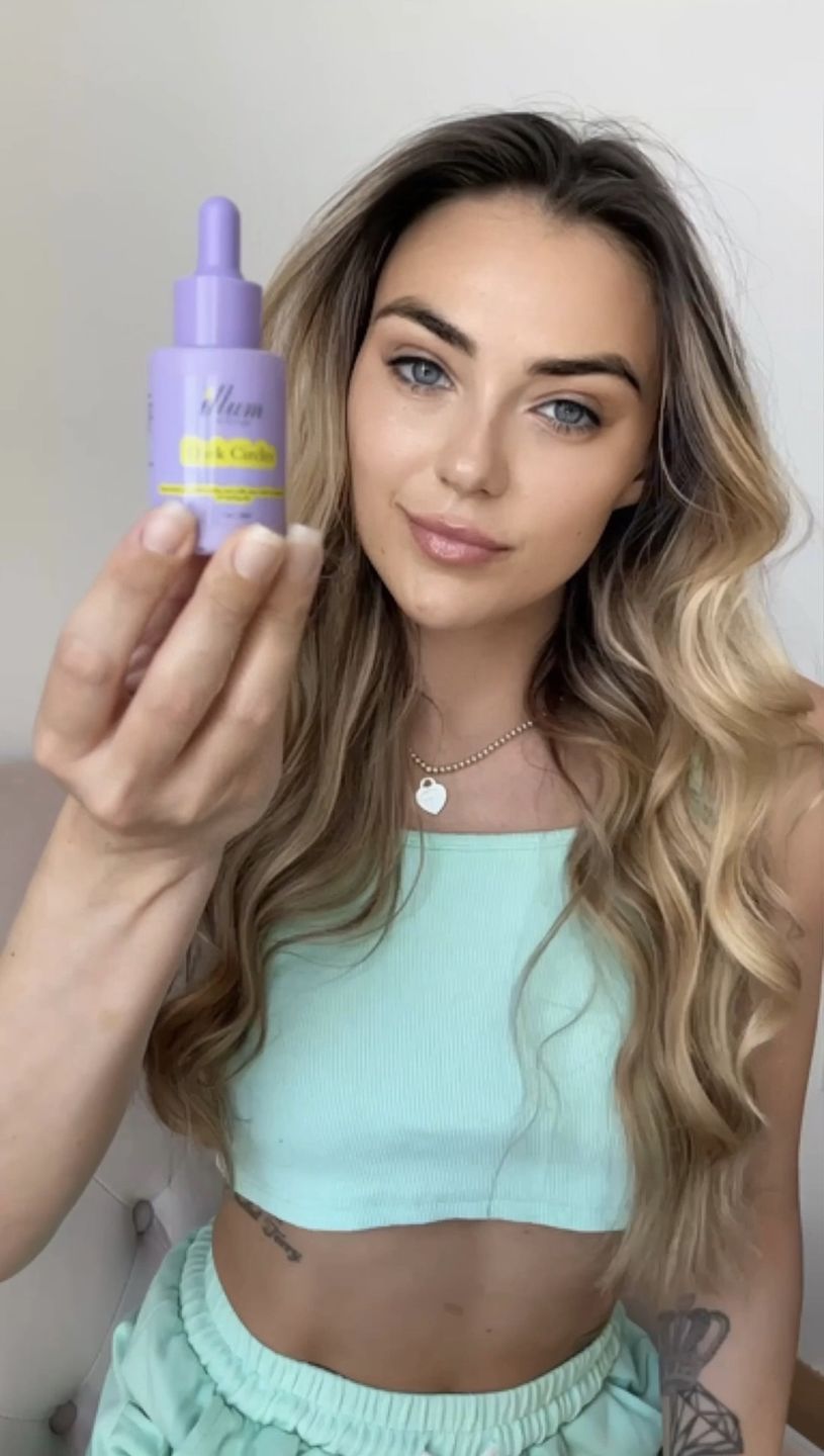 Customer photo review of Dark Circles Treatment