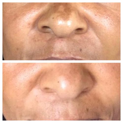 Customer photo from Xcape Serum Fan