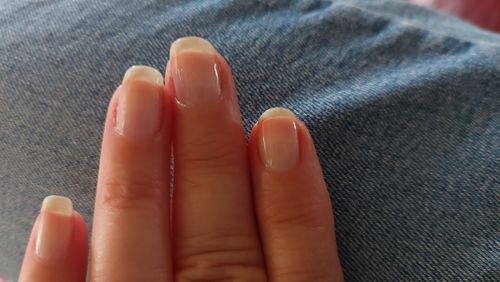 Customer photo review of Route Package Protection