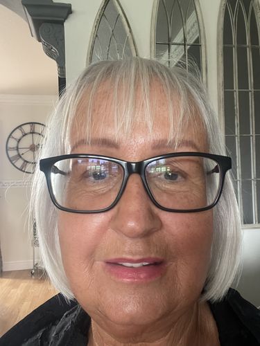 Customer photo review of Rosalique 3 in 1 Anti-Redness Miracle Formula SPF50