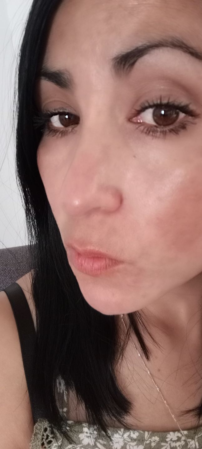 Customer photo review of Kit Los Esenciales (29% OFF) - Serum de Vitamina C 30ml + Serum de Niacinamida 30ml + Serum de Ácido Hialurónico 30ml