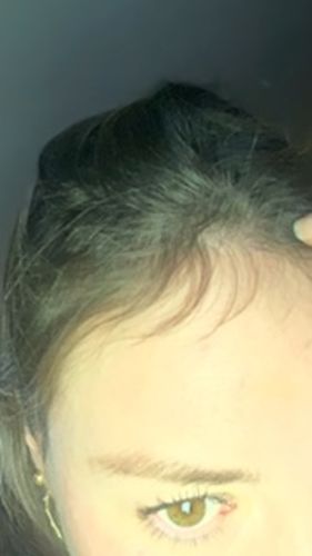 Customer photo review of Shampoo Control Caida Normal + Acondicionador Caida 350ml