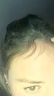 Customer photo review of Shampoo Control Caida Normal + Acondicionador Caida 350ml
