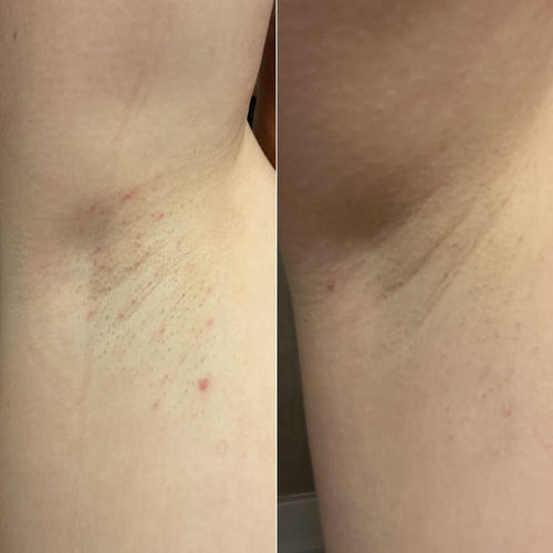 Customer photo review of Skin Glow Kit -Brightens & Even Skin Tone