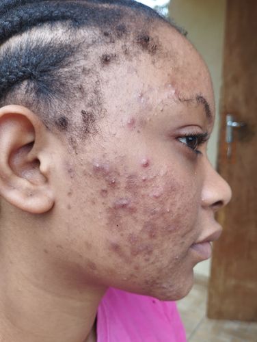 Customer photo review of Sample size - 20g Qasil Powder