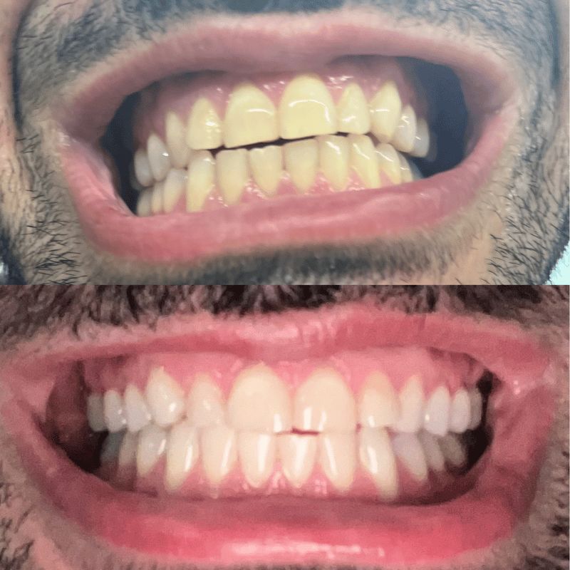 Leo Z. review of besmille