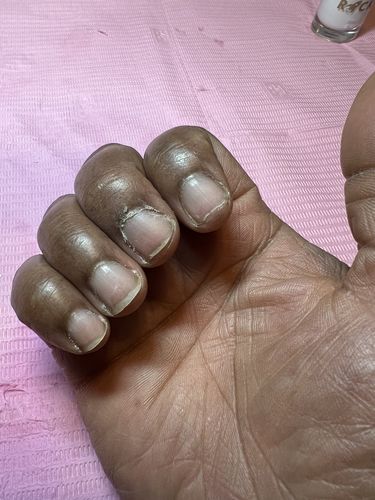 Customer photo review of Rocket Nail Fuel Duo