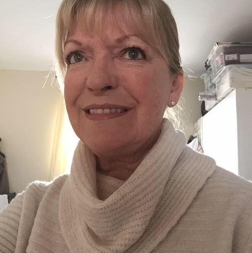 Customer photo review of Rosalique 3 in 1 Anti-Redness Miracle Formula SPF50