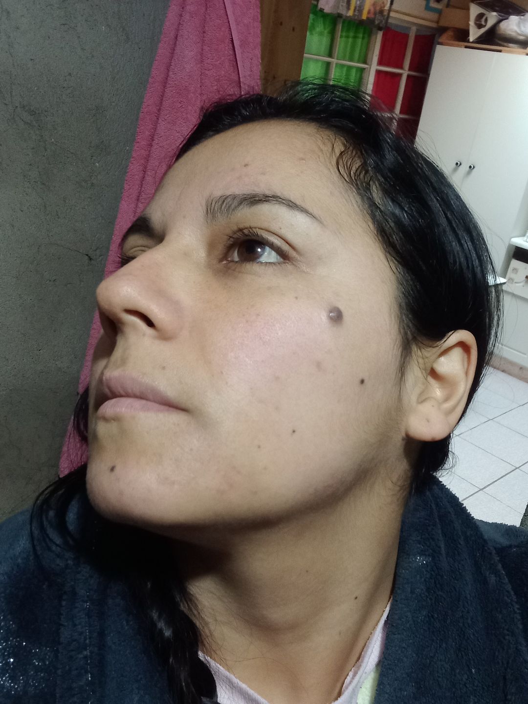 Customer photo review of Roll On Antimanchas y regenerante