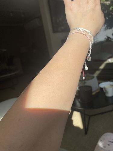 Customer photo review of Depilador Nuva Skin®