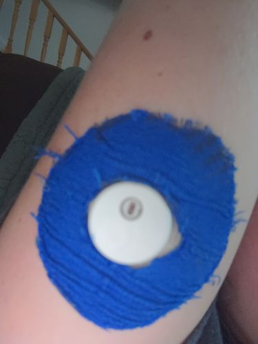 Customer photo review of Skin Grip Original - Universal Adhesive Patches (0.8 inch Hole)