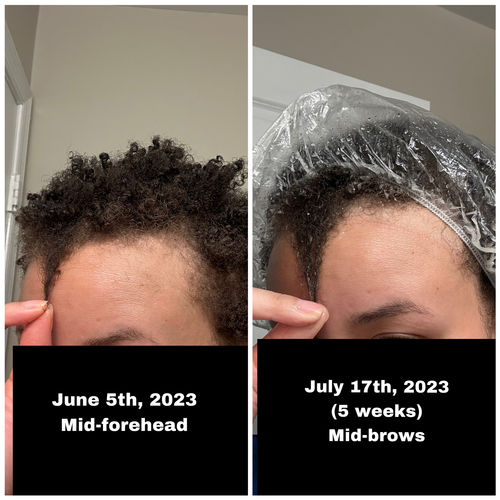 Customer photo review of Hydration Bundle