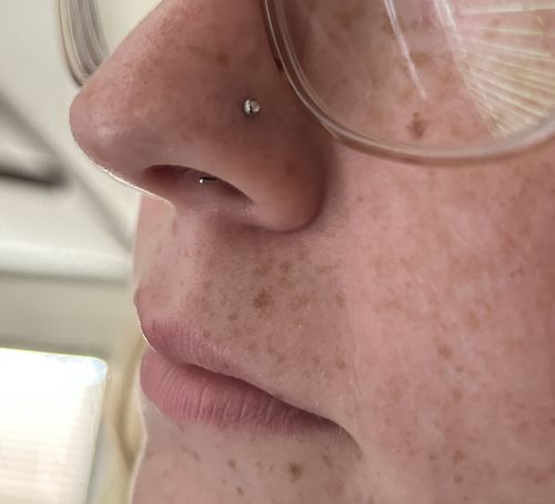 Customer photo review of Piercing Aftercare Straight Shooter Kit