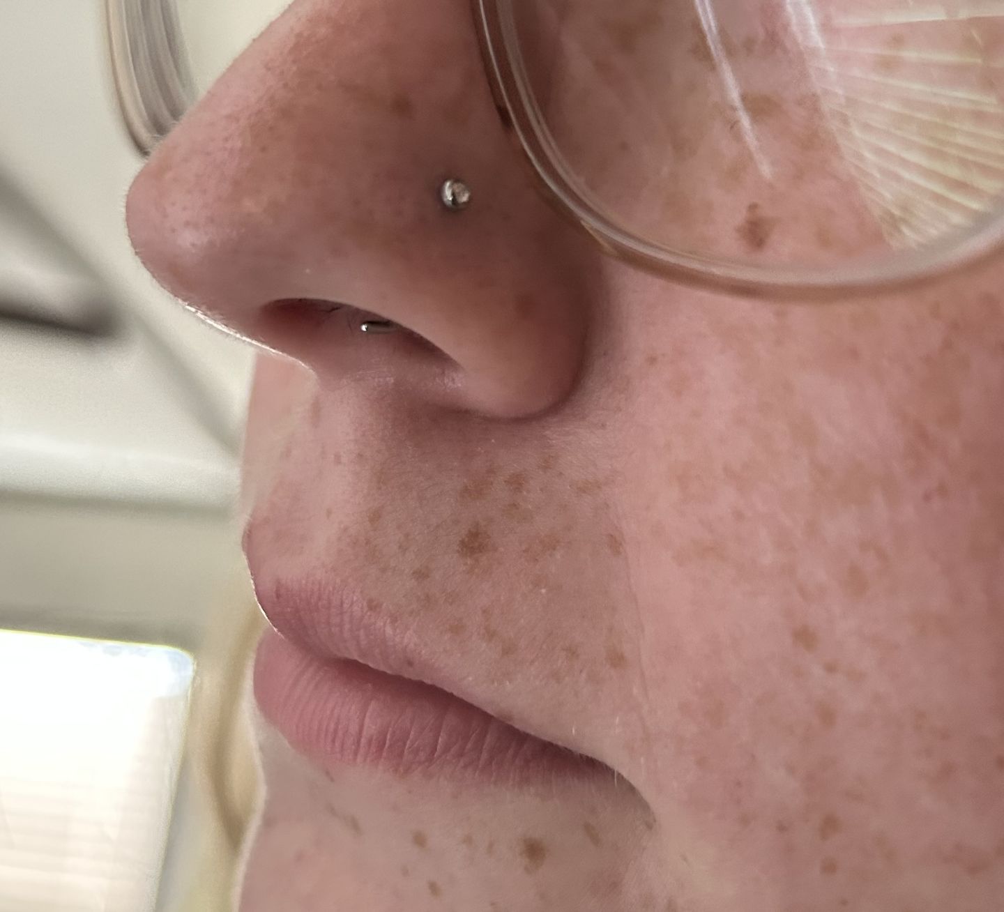 Customer photo review of Piercing Aftercare Straight Shooter Kit