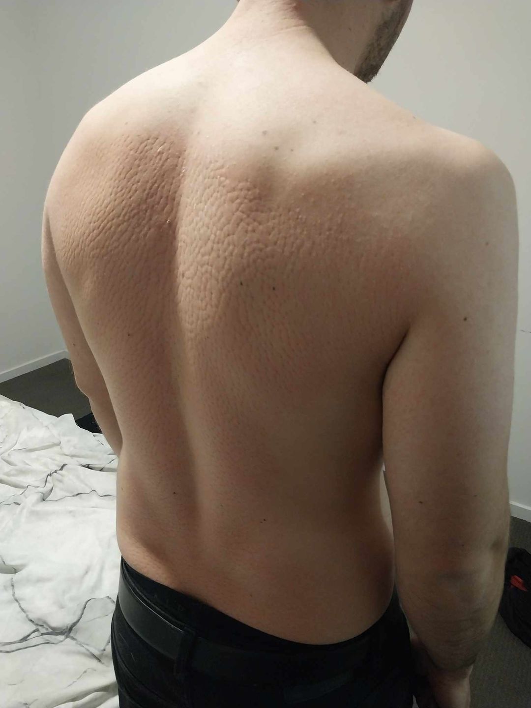 Customer photo review of Acupressure Mat Midnight
