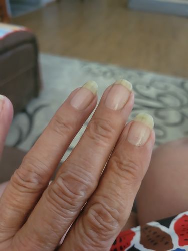Customer photo review of Rocket Nail Fuel Nail Repair - Clear