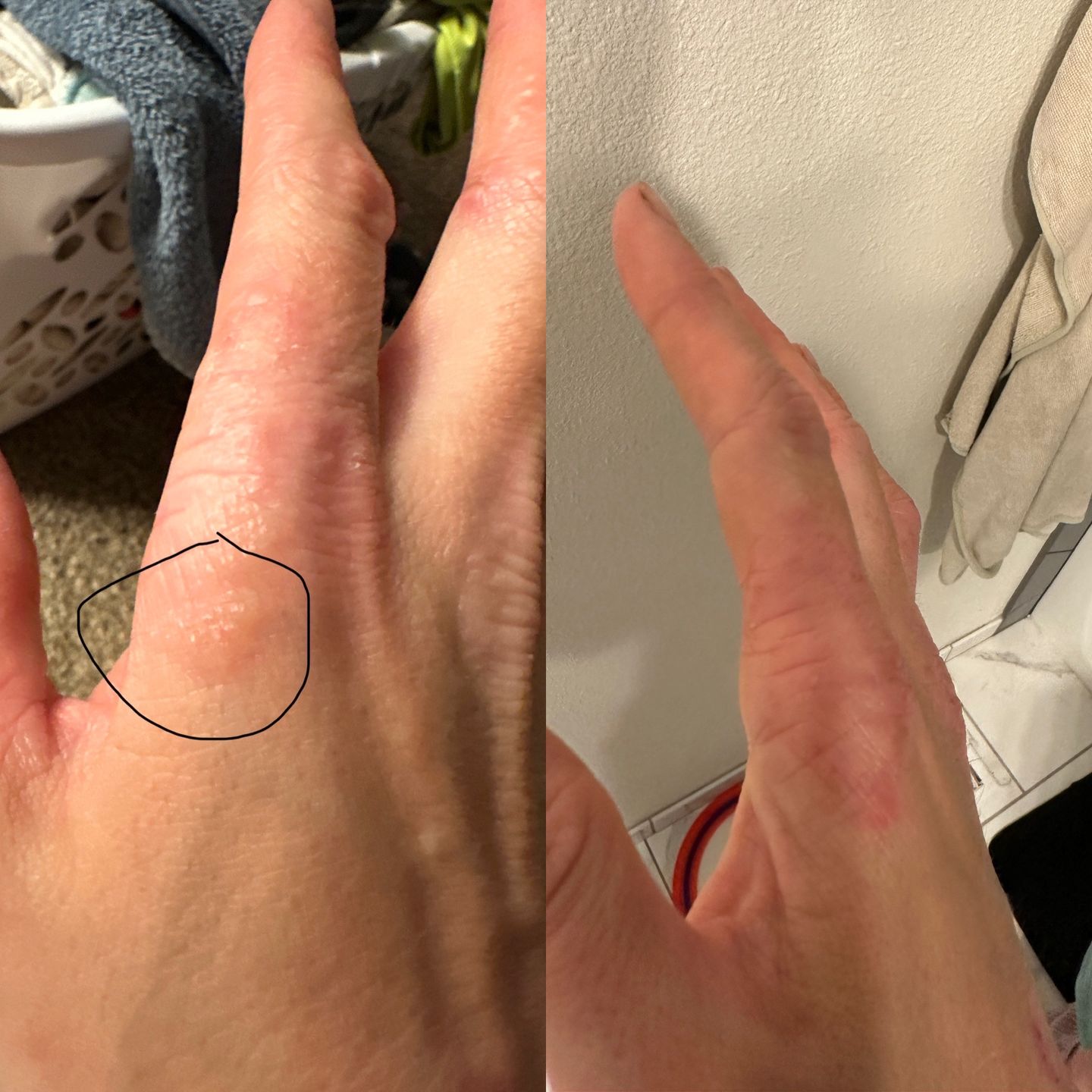 Customer photo review of Prebiotic Hand Cream