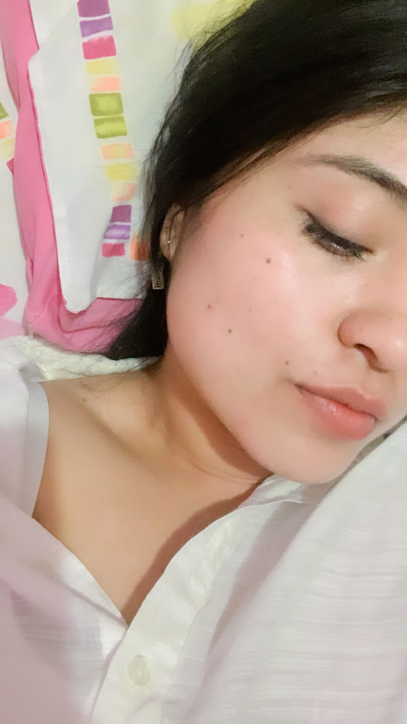 Customer photo review of Kit Los Esenciales (29% OFF) - Serum de Vitamina C 30ml + Serum de Niacinamida 30ml + Serum de Ácido Hialurónico 30ml