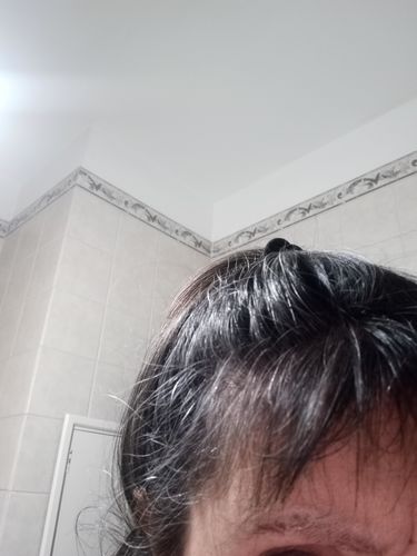 Customer photo review of Combo Hairfy - Vitaminas + Shampoo